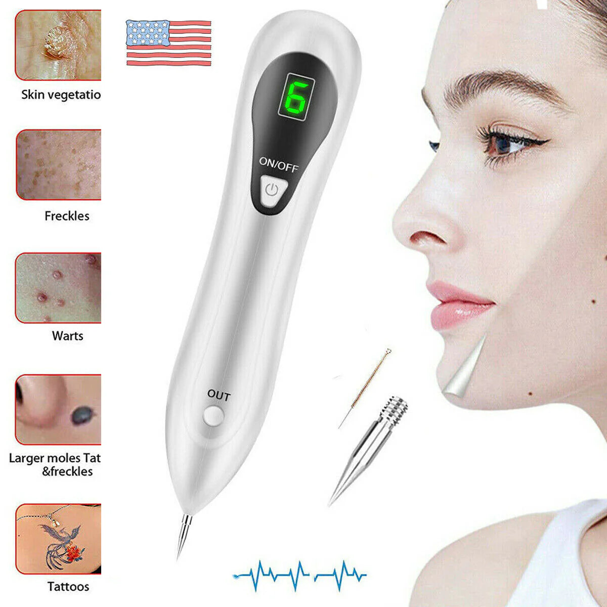Electric Laser Plasma Pen Mole Removal Dark Spot Remover Skin Wart Tag Tattoo